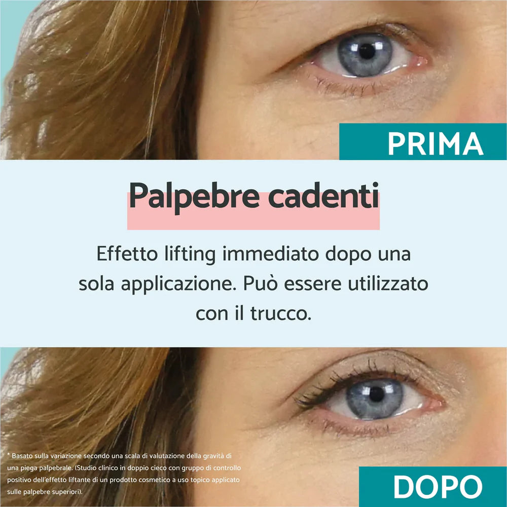 REMESCAR PALPEBRE CADENTI